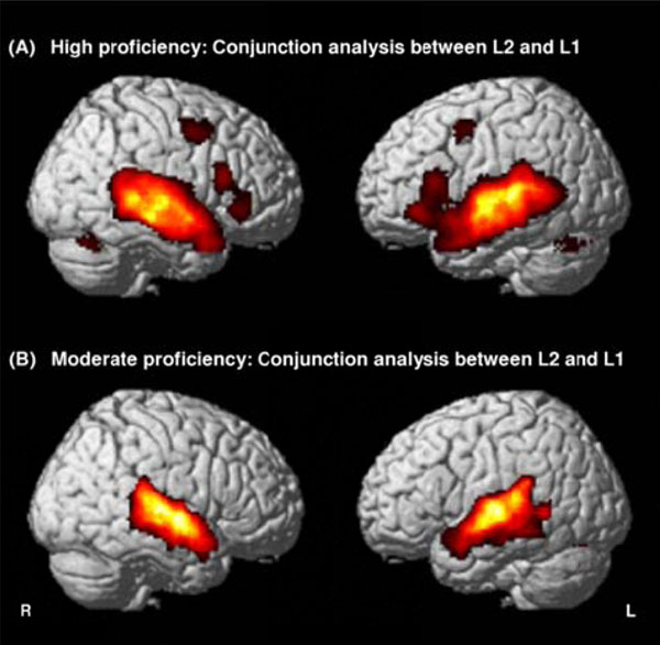 compared monolingual brain bilingual brain